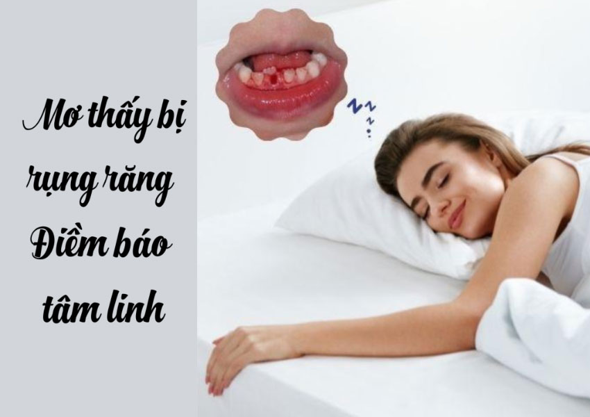Mơ thấy bị rụng răng - Điềm báo tâm linh